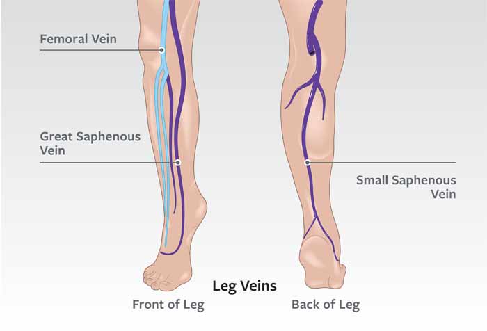 Drawing showing veins in legs
