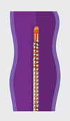 Drawing showing inserting a small catheter in leg